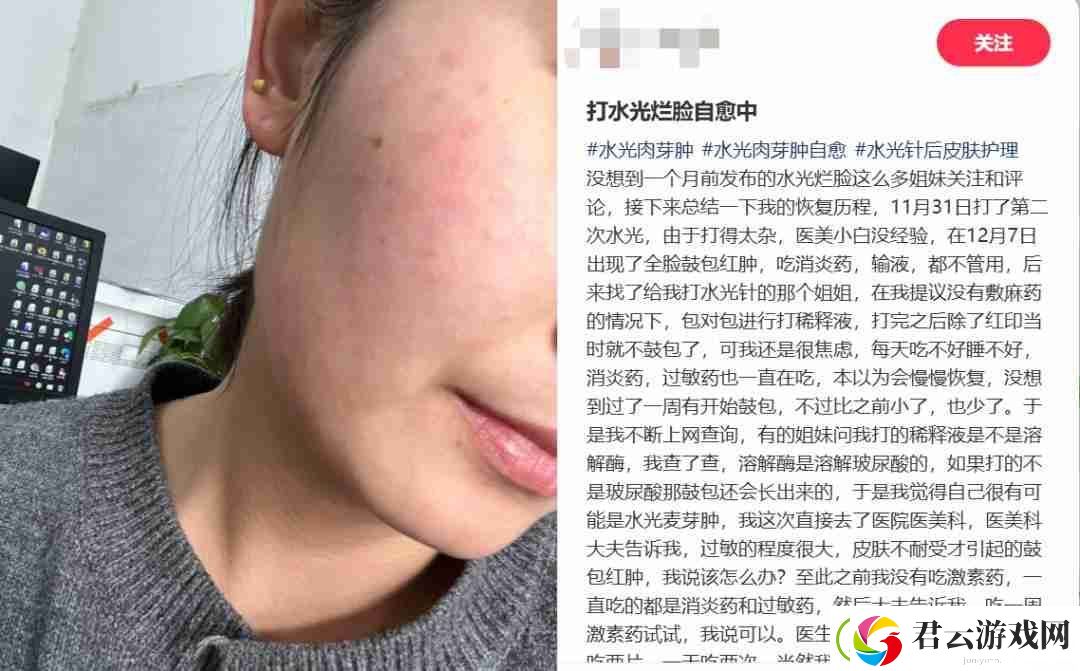 扎堆修复