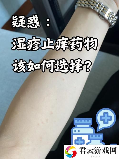 淑芬两腿间又痒痒的用药方法，如何有效缓解不适感