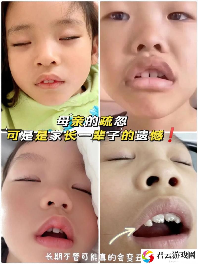 当“嘴巴太小含不下怎么办”？教你巧妙应对的小技巧诺布攻略